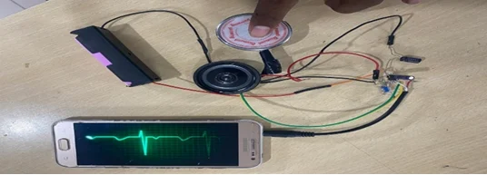 Wireless Stethoscope